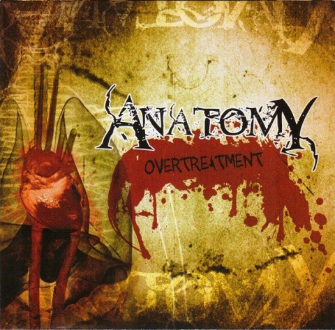ANATOMY – Overtreatment