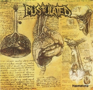 PUSTULATED- Haematoma