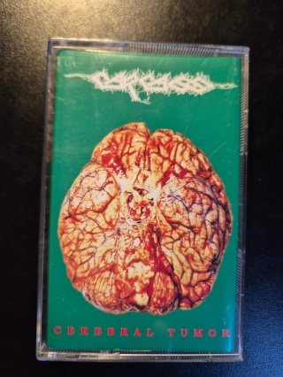 CARCASS- Cerebral Tumor