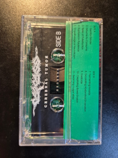 CARCASS- Cerebral Tumor