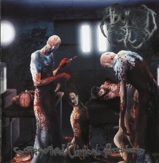 ABORTED FETUS- Goresoaked Clinical Accidents
