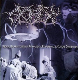 APOPLEXY- Medical Malpractioners Of Pathological Perversion And Clinical Cannibalism
